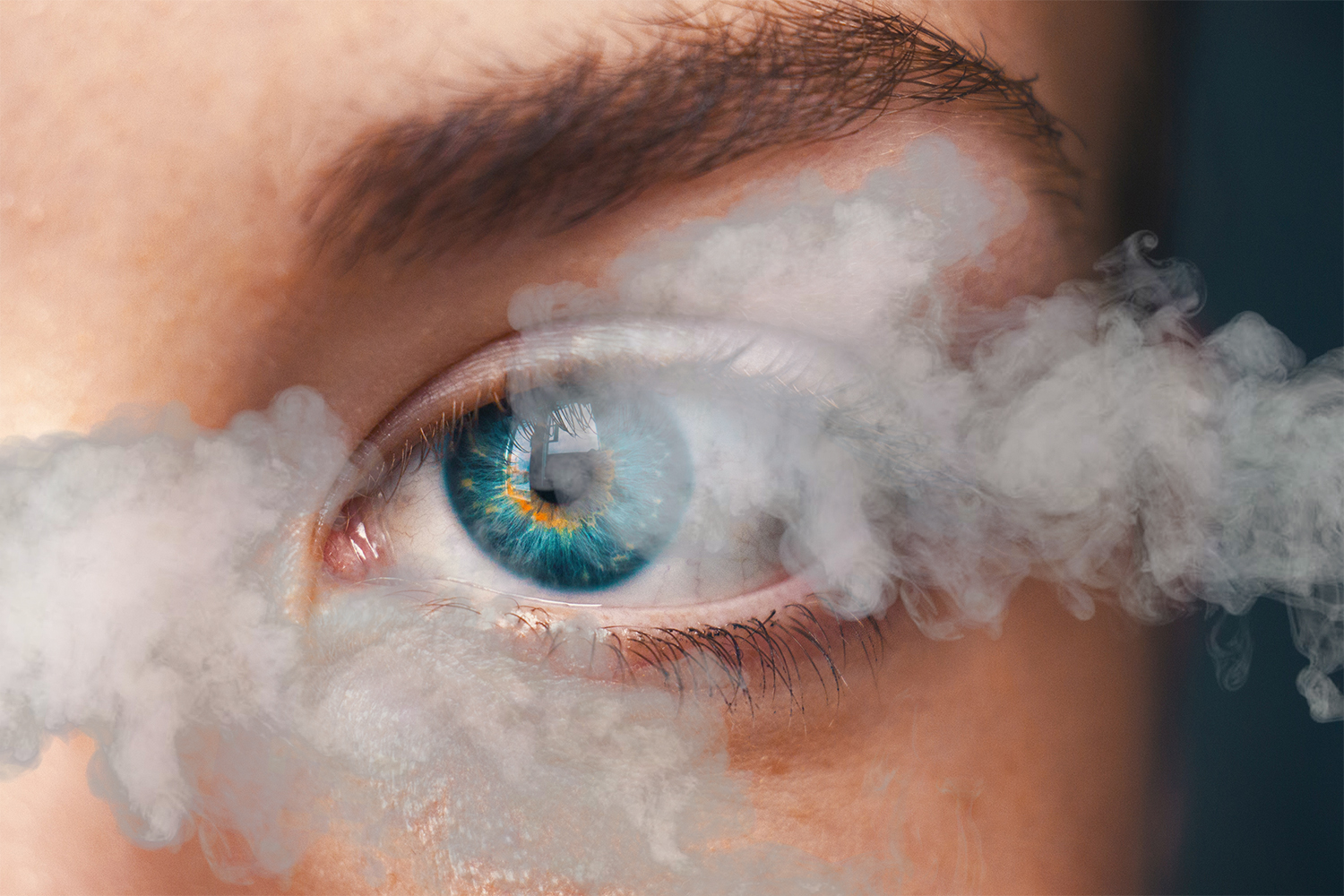 Congresso Euretina/ESCRS Paris