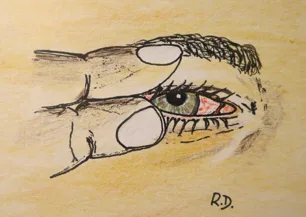 Openeye 1