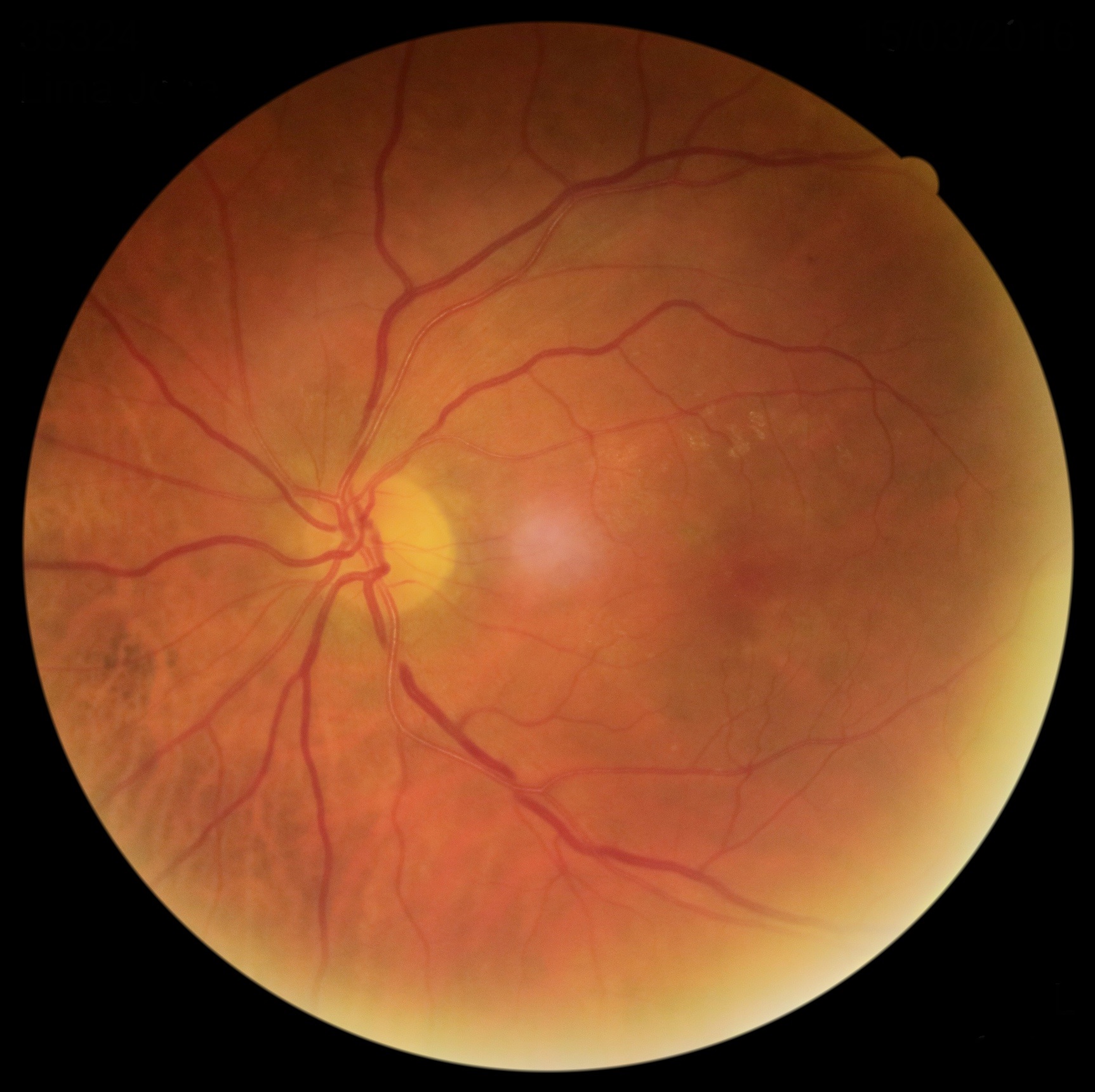 O que há de novo para um oftalmologista